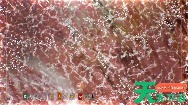 检疫区最后一站结膜炎与红眼区别一览